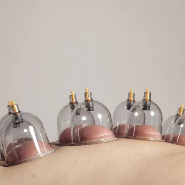 Cupping Add-On  $10